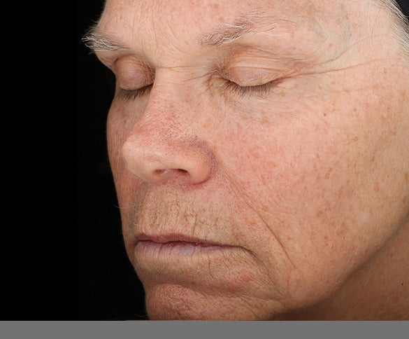 Skin baseline view