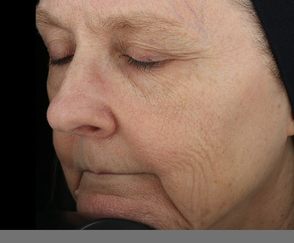 Skin baseline view